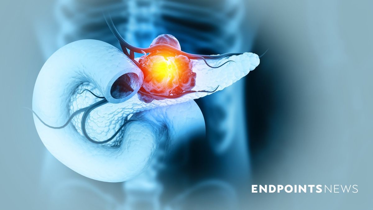 Compared to Herceptin's 1998 Approval: Pancreatic Cancer Hits a Turning Point